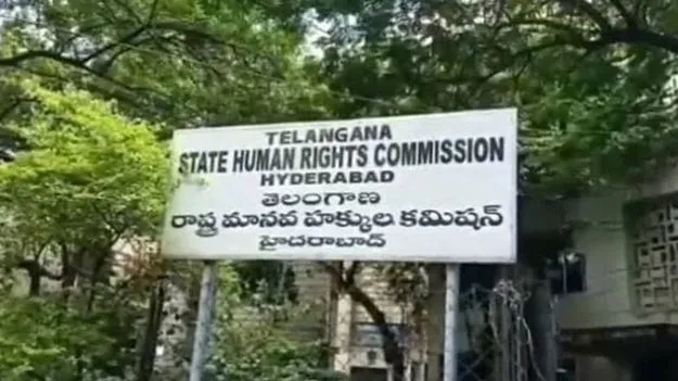 శిశువు చేయి తొలగింపు ఘటనపై హెచ్‌ఆర్సీ ఆగ్రహం
