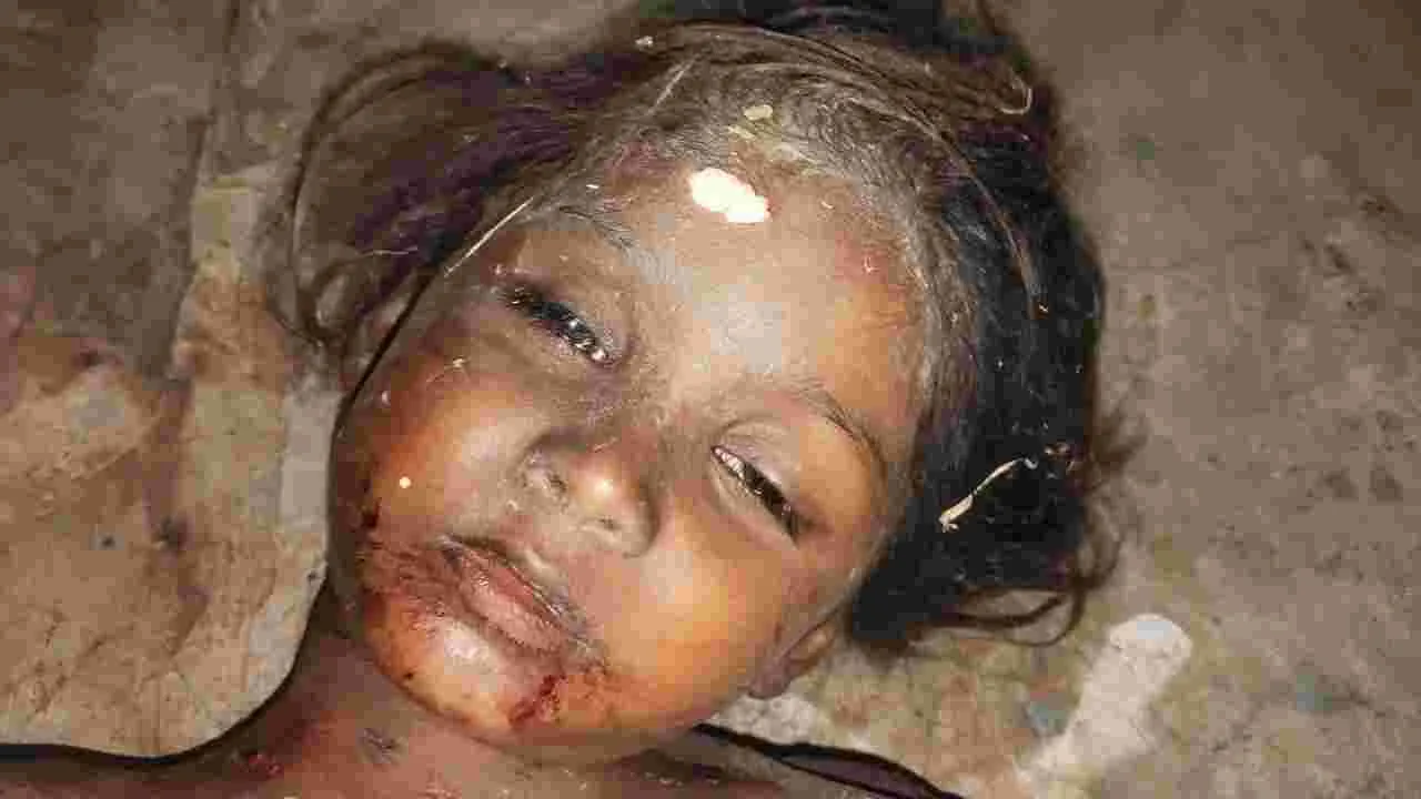 వీధి కుక్కల దాడిలో చిన్నారి మృతి