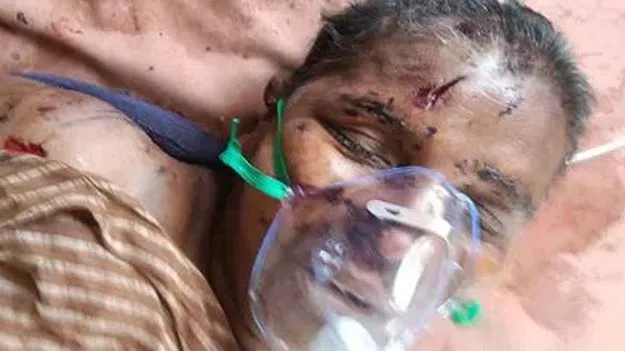 వీధి కుక్కల దాడిలో మహిళ మృతి 