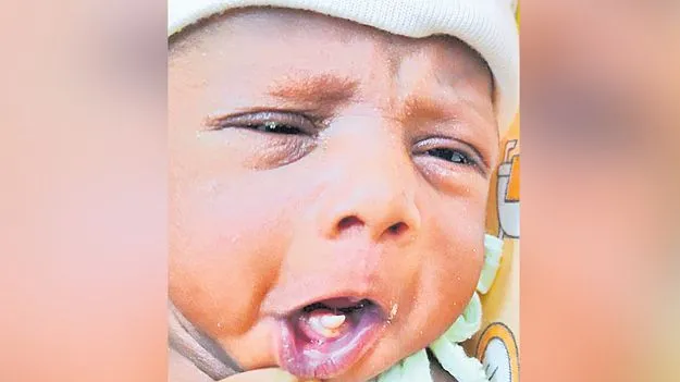పన్నుతో జన్మించిన శిశువు