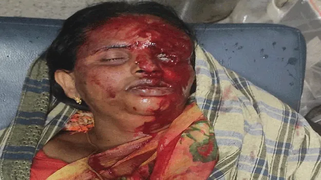  రెండు ద్విచక్రవాహనాలు ఢీ