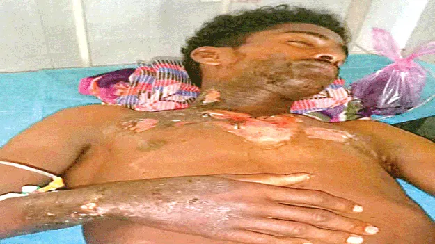 విద్యుదాఘాతంతో ఒకరికి తీవ్ర గాయాలు 