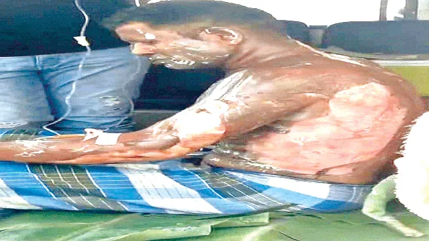 పెట్రోల్‌ పోసి.. నిప్పంటించి..