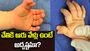 చేతికి ఆరు వేళ్లు ఉంటే అదృష్టమా?