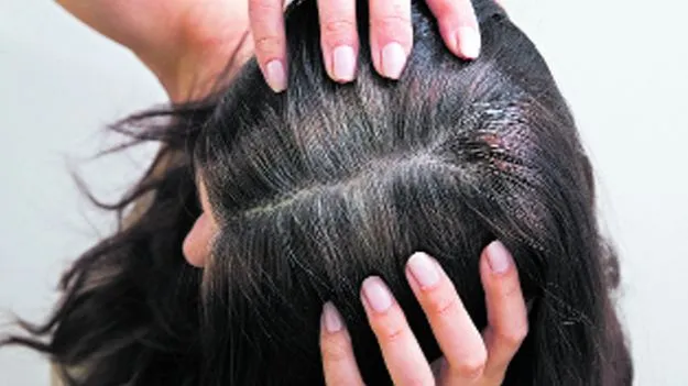 శిరోజాలు నెరుస్తున్నాయా..?