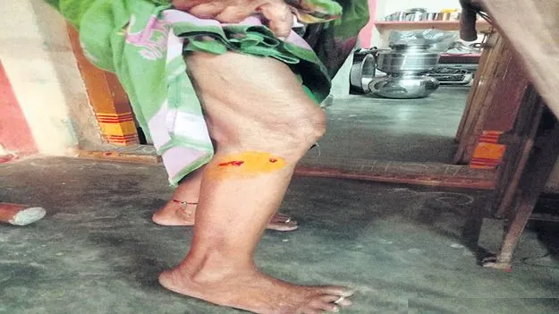 వీధి కుక్కల స్వైర విహారం
