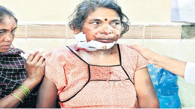 మహిళపై కత్తితో దాడి
