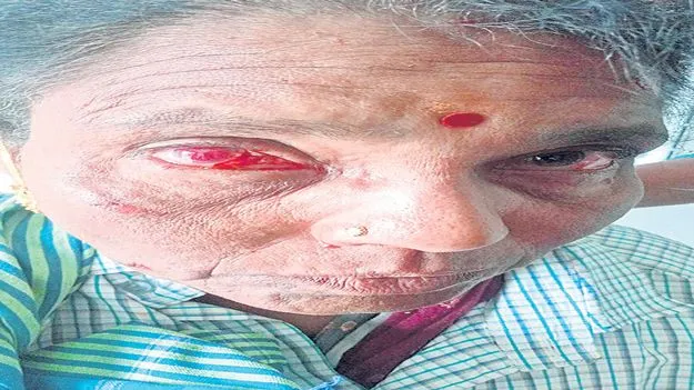 పూడికతీత పనుల్లో పేలుడు