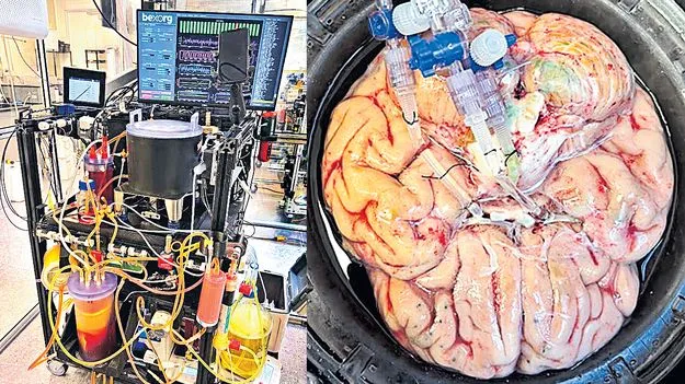 మానవ మెదళ్లపై ఔషధ ప్రయోగాలు