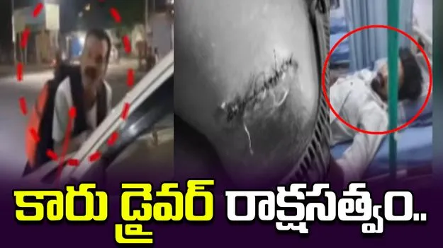 హైదరాబాద్‌లో కారు డ్రైవర్ రాక్షసత్వం.. ఓ వ్యక్తిని ఢీకొట్టి ఆపై..