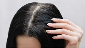 తెల్ల జుట్టును నల్లగా మార్చే సహజ చిట్కా!