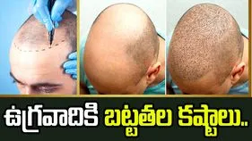 ఉగ్రవాదికి బట్టతల కష్టాలు.. దాడులు చేయడానికి భారత్‌లోకి చొరబడి..