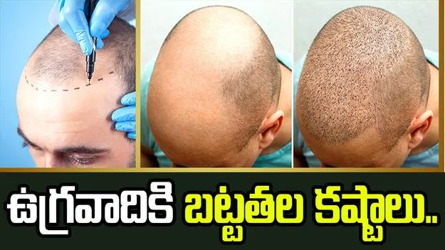 ఉగ్రవాదికి బట్టతల కష్టాలు.. దాడులు చేయడానికి భారత్‌లోకి చొరబడి..