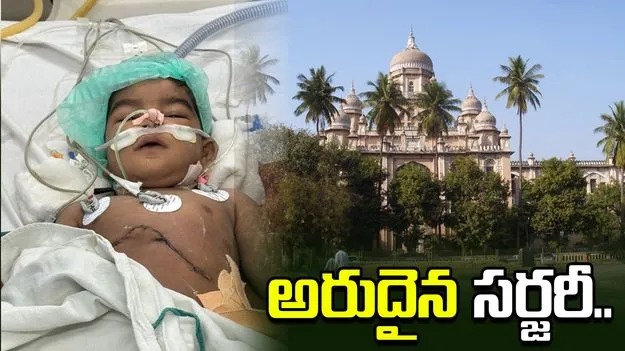 ఉస్మానియాలో అరుదైన సర్జరీ.. వైద్య బృందానికి మంత్రి దామోదర్ ప్రశంసలు..