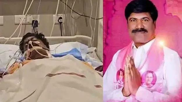 పెద్ది సుదర్శన్‌రెడ్డికి కొనసాగుతున్న చికిత్స