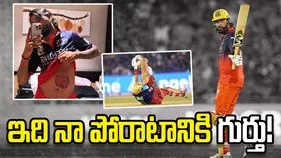 ముంబై ఇండియన్స్‌తో మ్యాచ్‌లో గాయం.. ఫొటోను పంచుకున్న కృనాల్ పాండ్య