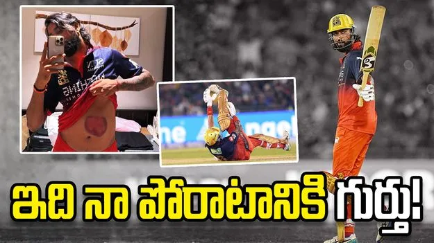 ముంబై ఇండియన్స్‌తో మ్యాచ్‌లో గాయం.. ఫొటోను పంచుకున్న కృనాల్ పాండ్య