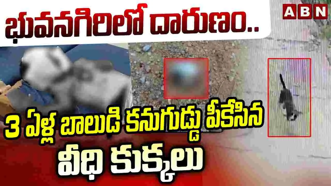 చిన్నారి కనుగుడ్డు పీకేసిన వీధి కుక్కలు..