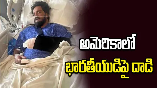 అమెరికాలో భారతీయుడిపై దాడి.. నువ్వు ముస్లింవా అని అడిగి ఆపై..