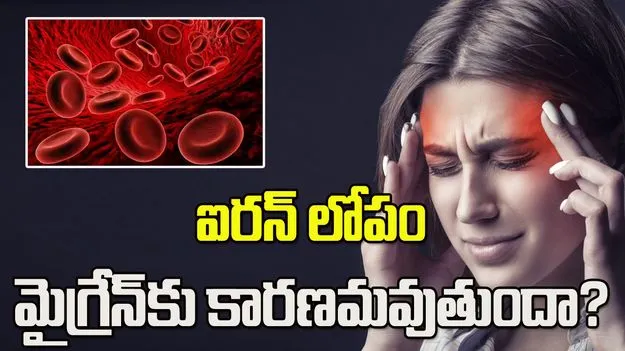 ఐరన్ లోపం.. మైగ్రేన్‌కు కారణమవుతుందా?