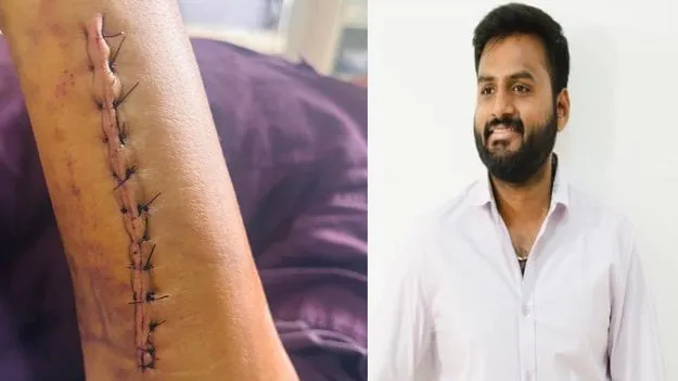 కొండా సురేఖ మాజీ ఓఎస్డీపై హత్యాయత్నం కేసు!