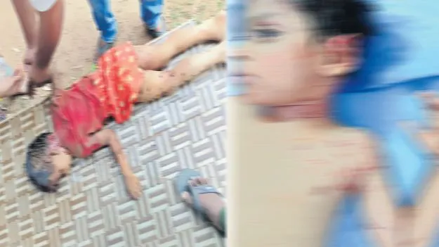 చిన్నారిపై వీధి కుక్కల దాడి