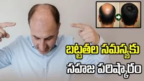 బట్టతల సమస్యకు సహజ పరిష్కారం