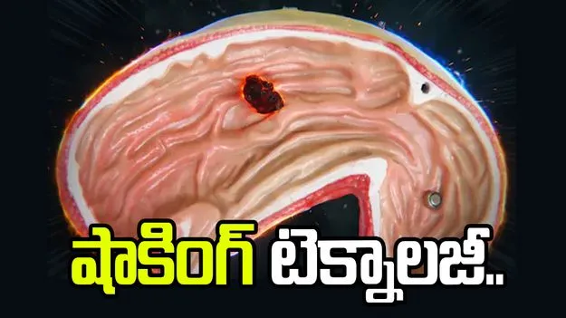 షాకింగ్ టెక్నాలజీ.. స్లైమ్ రోబోతో సులభంగా ఆపరేషన్లు..