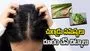 వేసవిలో చుండ్రు, మాడు దురద సమస్యలా?  ఈ చిట్కాలతో చెక్ పెట్టండి