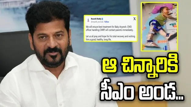 ‘ఉత్తమ వైద్యం అందిస్తాం’.. చిన్నారి ఆర్యాంశ్‌కు సీఎం రేవంత్ అండ