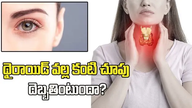 థైరాయిడ్ వల్ల కంటి చూపు దెబ్బతింటుందా?