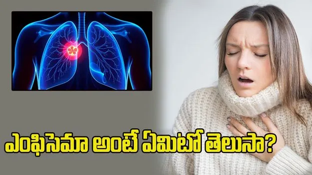 శ్వాస తీసుకోవడంలో ఇబ్బందా? ఎంఫిసెమా వ్యాధి గురించి తెలుసుకోండి