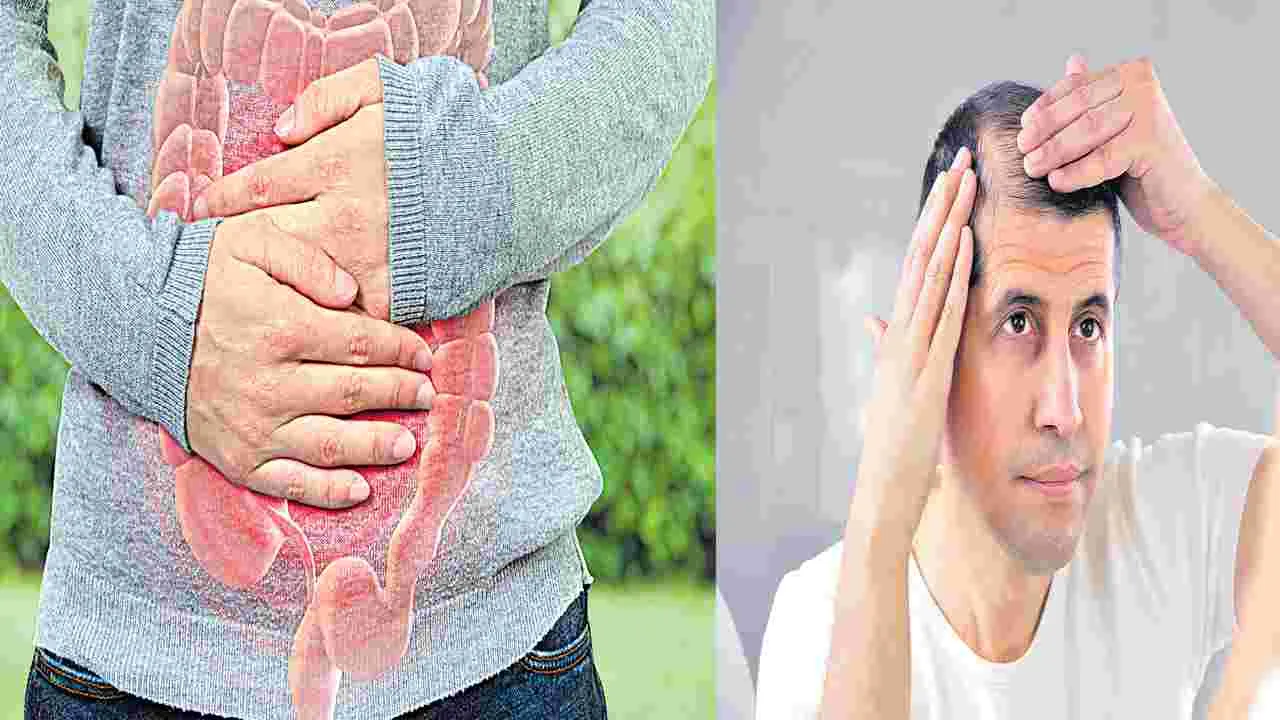 తిన్నది అరగట్లేదు.. జుట్టు ఊడిపోతోంది!