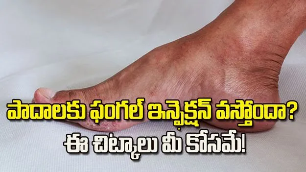 వర్షాకాలంలో పాదాలకు ఫంగల్ ఇన్ఫెక్షన్ వస్తోందా? ఈ చిట్కాలు మీ కోసమే