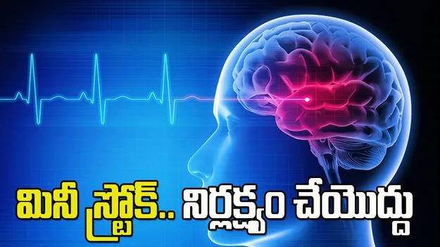 మినీ స్ట్రోక్.. ఈ లక్షణాలను అస్సలు నిర్లక్ష్యం చేయొద్దు
