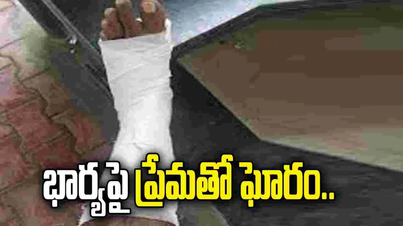 అన్నమయ్య జిల్లాలో కలకలం..  భార్యపై ప్రేమతో కాలు నరుక్కున్న భర్త