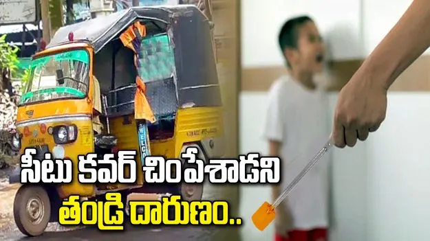 కాకినాడలో దారుణం.. ఆటో సీటు చింపేశాడని కొడుకుకు వాతలు పెట్టిన సైకో తండ్రి 