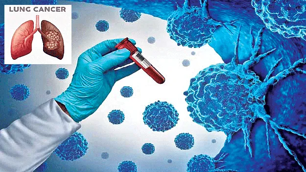 అమ్మో.. క్యాన్సర్‌