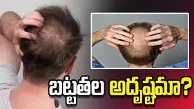 బట్టతల అదృష్టమా? జ్యోతిష్యం ఏమి చెబుతోంది?