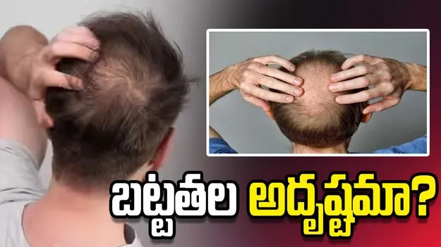 బట్టతల అదృష్టమా? జ్యోతిష్యం ఏమి చెబుతోంది?