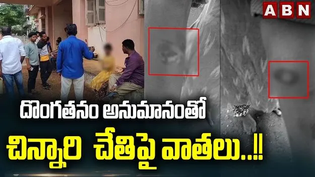 అల్లూరి జిల్లాలో అమానుషం.. బాలికకు అట్లకాడతో వాతలు