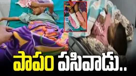 మేడారంలో ఘోర ప్రమాదం.. రాతి కట్టడం పడి బాలుడి కాలు తొలగింపు