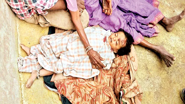 బోసినవ్వులు మాయం 