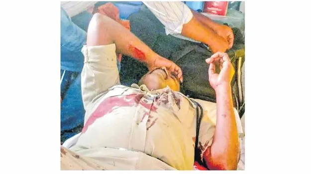పేలిన ఏఆర్‌ కానిస్టేబుల్‌ తుపాకీ