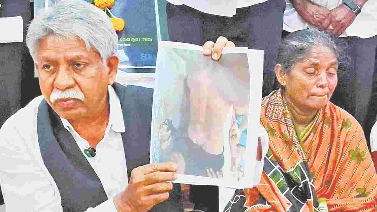 చిత్రహింసలతోనే చీకటి గోపి మృతి