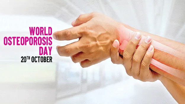 లక్షణాలు కనిపించవు.. ఎముకలు గుల్లబారుతాయ్‌