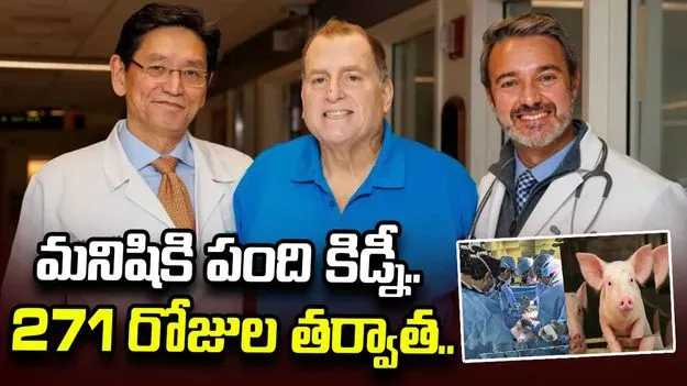మనిషికి పంది కిడ్నీ అమర్చిన డాక్టర్లు.. 271 రోజుల తర్వాత ఏమైందంటే..