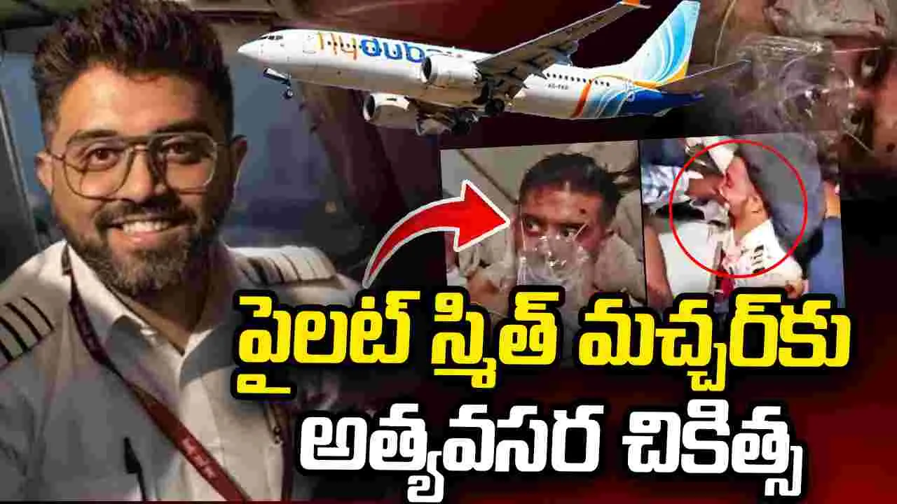 కాక్పిట్లో దాడితో తీవ్రంగా గాయపడిన కెప్టెన్ స్మిత్.. అత్యవసర చికిత్స చేసిన డెంటెస్ట్ – general కాక్పిట్లో దాడితో తీవ్రంగా గాయపడిన కెప్టెన్ స్మిత్.. అత్యవసర చికిత్స చేసిన డెంటెస్ట్ – general