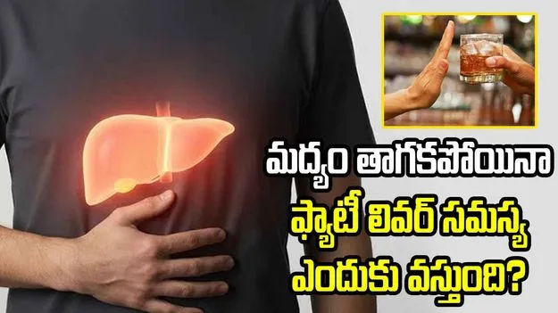 మద్యం తాగకపోయినా ఫ్యాటీ లివర్ సమస్య ఎందుకు వస్తుంది? అసలు కారణాలివే.!