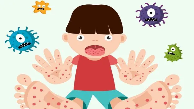 ‘హ్యాండ్‌, ఫుట్‌, మౌత్‌’ డిసీజ్‌ పంజా